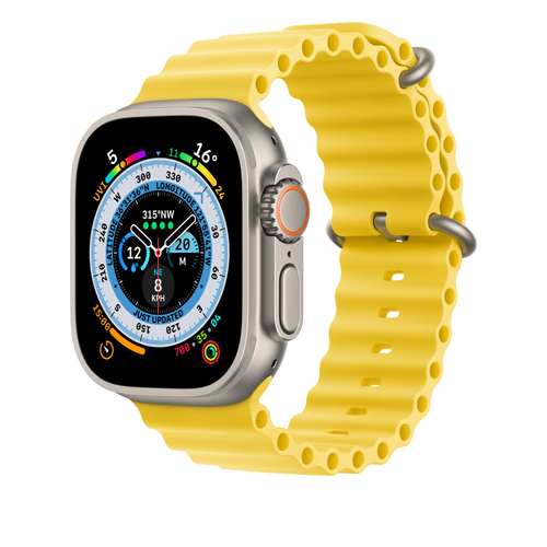 Bild von Apple MQED3ZM/A Smart Wearable Accessoire Band Gelb Fluor-Elastomer